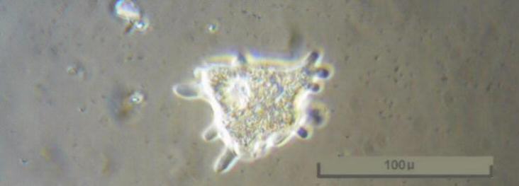 AMOEBA.JPG