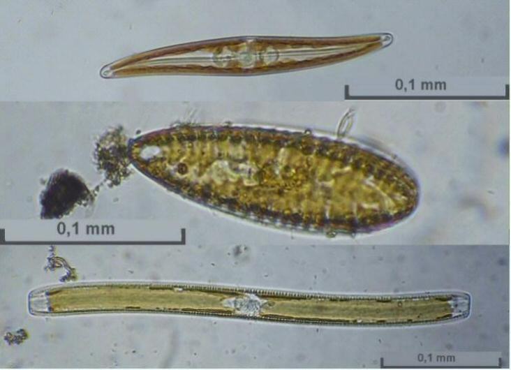 DIATOM.JPG