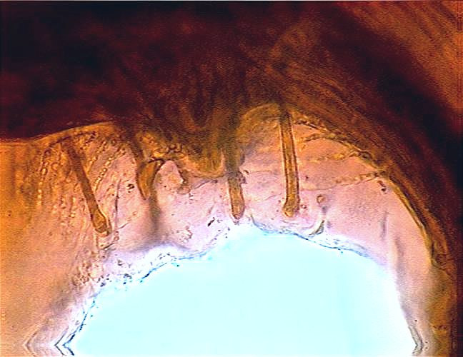 22-eosine
